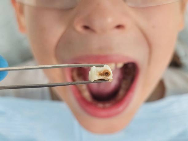 Best Pediatric Emergency Dentist in Ragland, AL