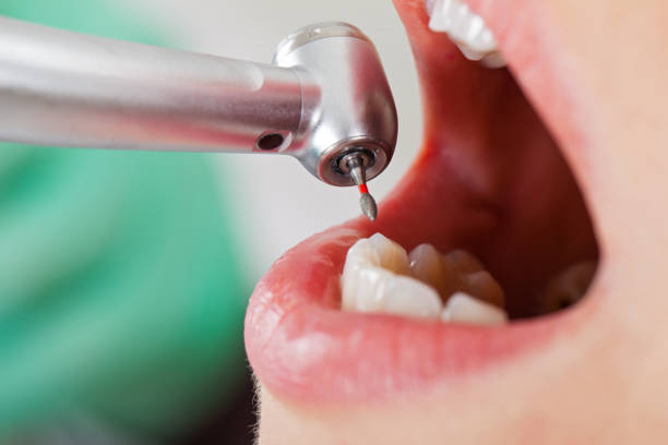 Best Emergency Dental Services for Seniors in Ragland, AL